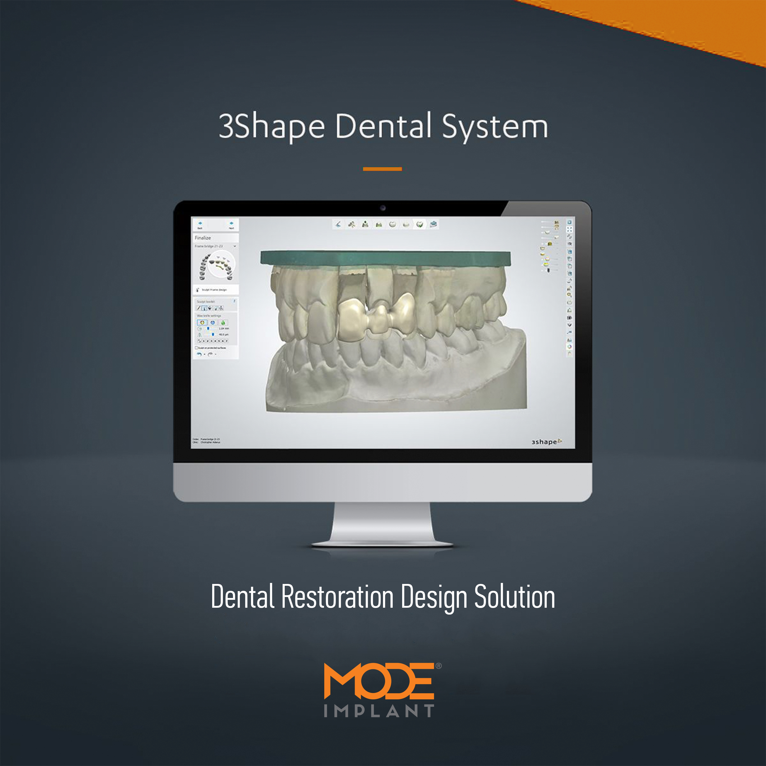 3SHAPE Dental System CAD Points