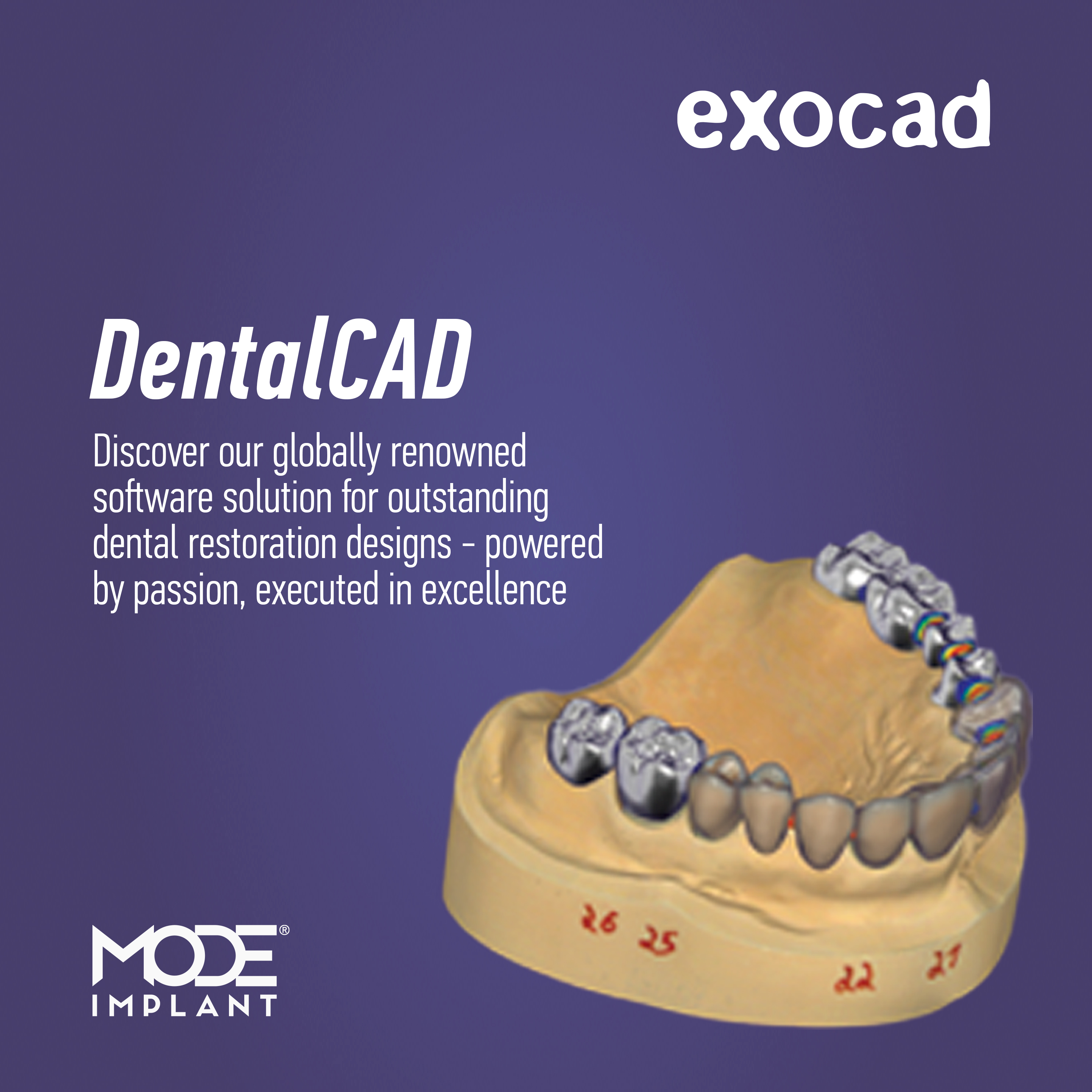 EXOCAD Implant libraries for Dental CAD