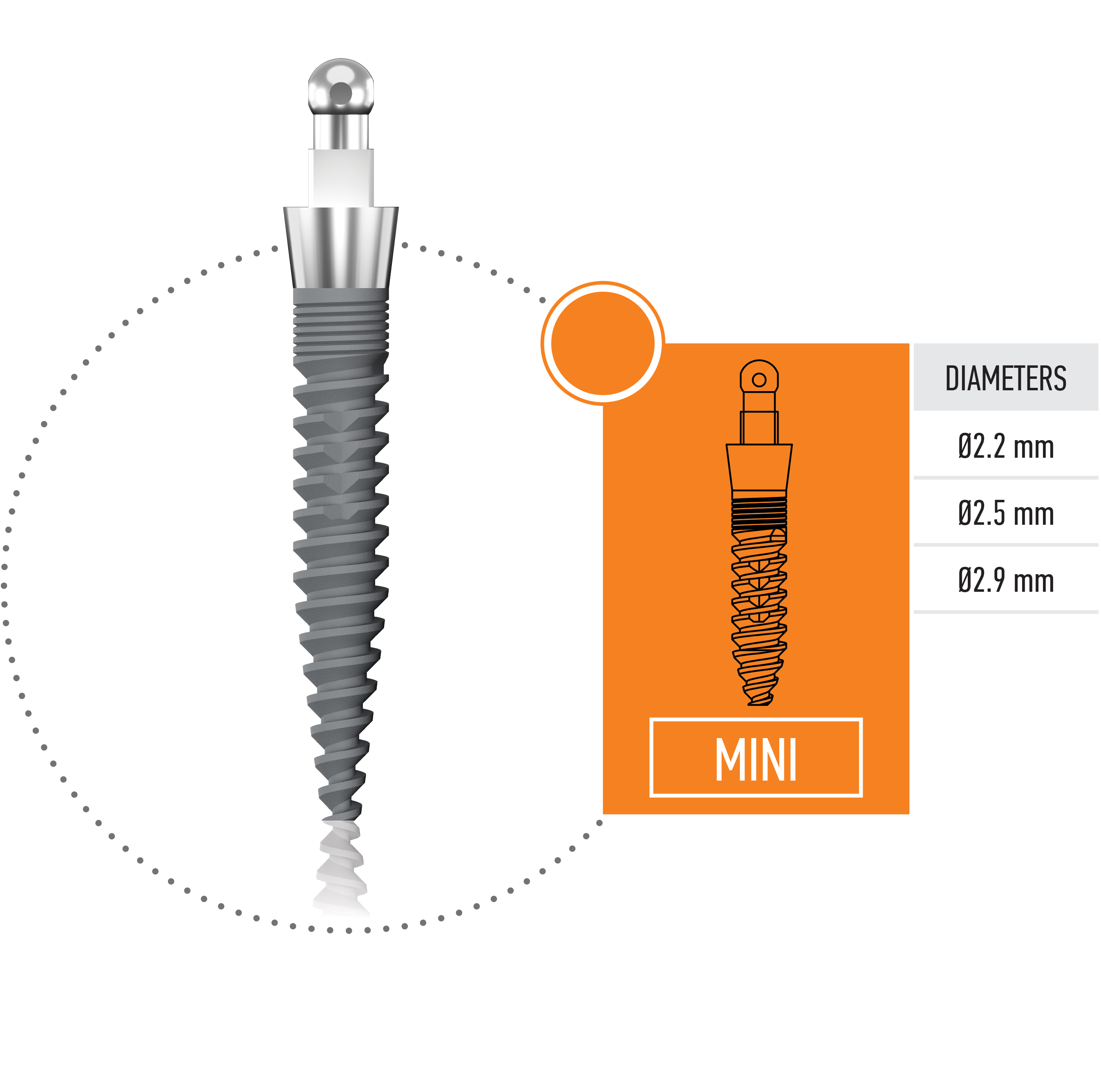 <span>Mini</span> Implant